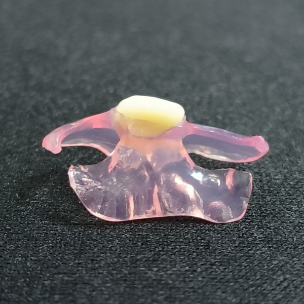Personalized Customized Valplast Flexible Denture Durable Natural Looking