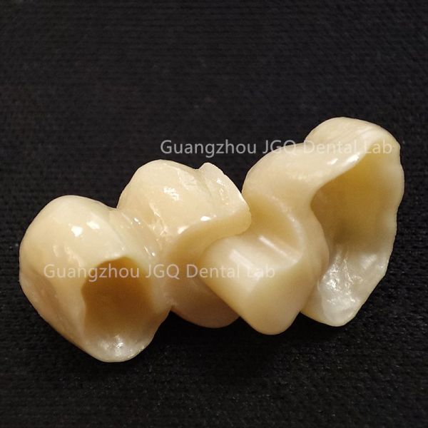 Dual Zirconia Crown Bridge Precision Crafted By China Dental Lab