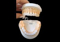 Coroa dental de zircônio de translucidez melhorada para restaurações fixas de unidade única / múltipla