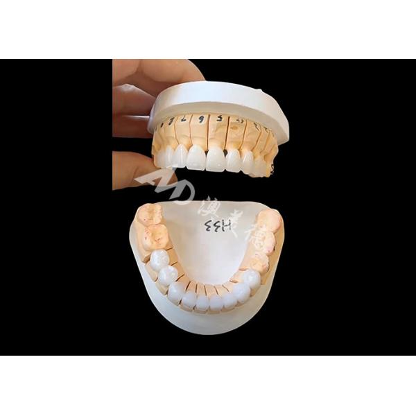 Улучшенная транспарентность циркониевая зубная корона для однократных / многокра