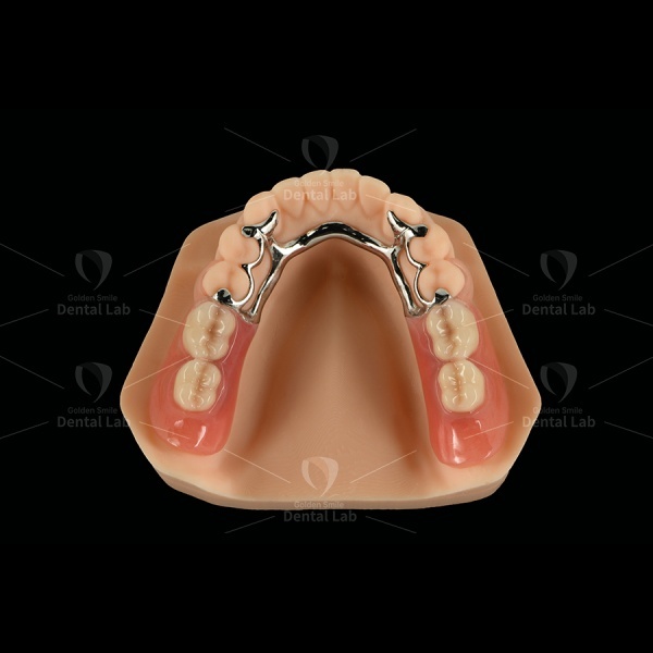Lightweight Cobalt Chrome Partial Denture Framework Clasp Flexible Acrylic Partial Denture