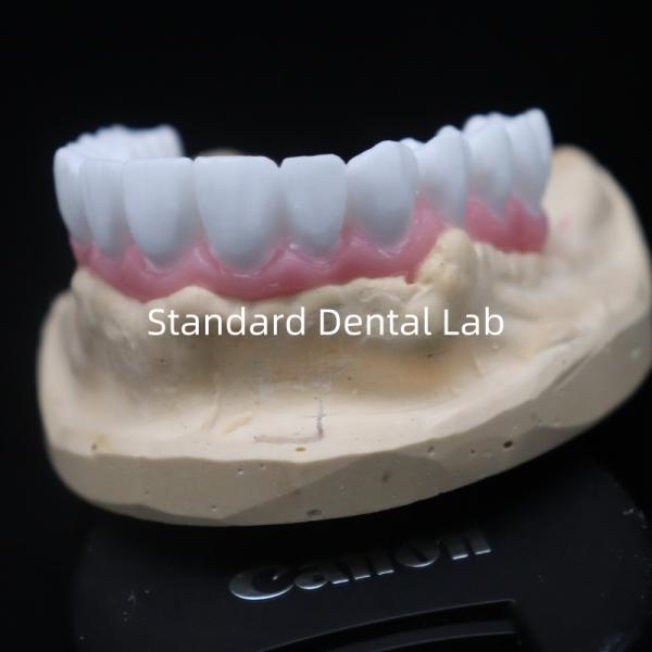 Высокая Эстетика Белая Зубная Корона Диагностический Вакс До Customized Китайская стоматологическая лаборатория