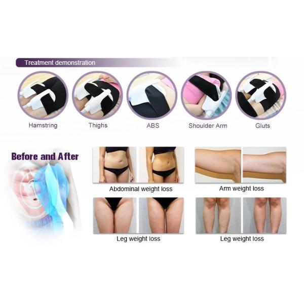 Therapy EMS Electronic Muscle Building Machine Body Sculpting ABS White Color