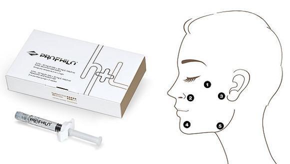 アンチエイジングとシミ除去 プロフィロ H L 2ml ヒアルロン酸 32mg/ml Ha 濃度