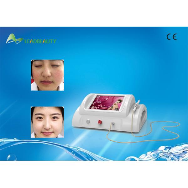 30Mhz vascular removal Therapy spider veins vascular removal / blood vessel
