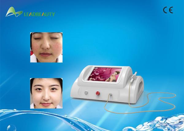 30MHz RBS beauty machine laser blood vessel skin tag removal device