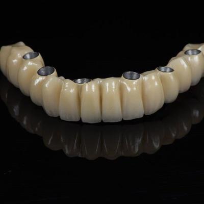 Cad Cam Implant PFM Crown Bridge Dental Medical Grade Adhesive