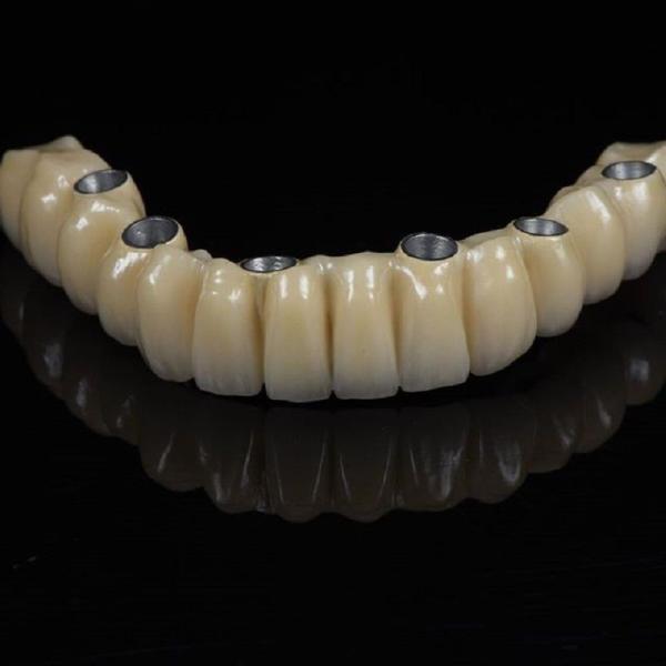 Cad Cam Implant PFM Crown Bridge Dental Medical Grade Adhesive