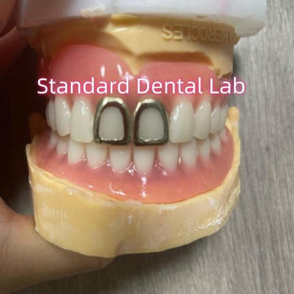 ISO полные акриловые зубные протезы с желтым золотом зубы открытый лицо