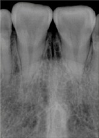 Время 60В удобного Хандхэльд зубоврачебного оборудования цифров кс Рэй регулируемое