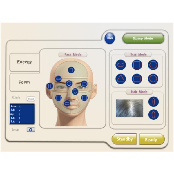 Handheld Probe Anti Wrinkle Machine 1550nm Er Glass Laser
