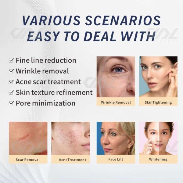 2 In 1 RF Microneedling Machine For Skin Tightening / Acne Scar Treatment Clinics