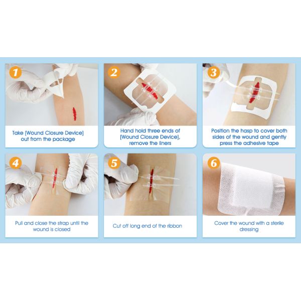 PWT1002 Flexible Fabric Bandages Wound Closure Device 4PCS