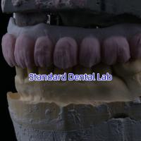 Porcelana All On Four Ponte de zircônio Ponte de implantes dentários de alta estética