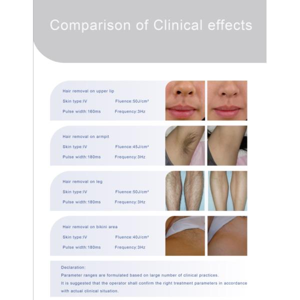 depilation laser hair removal laser Diode laser hair removal,quickly and painless for all skin type,Factory price