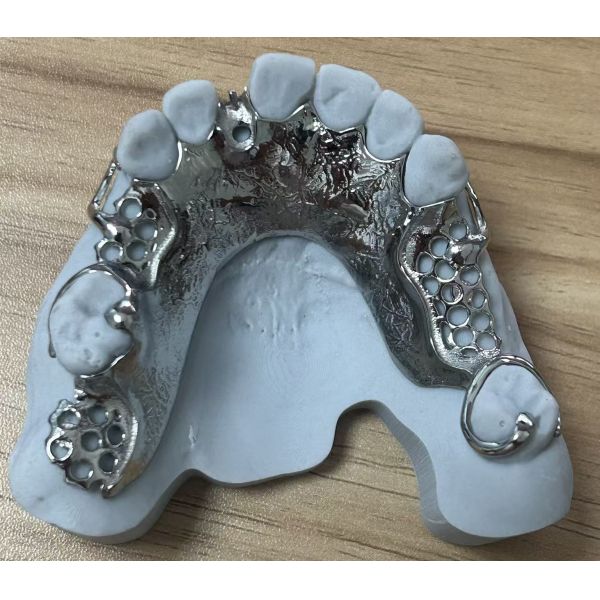 Cast Partial Denture Framework
