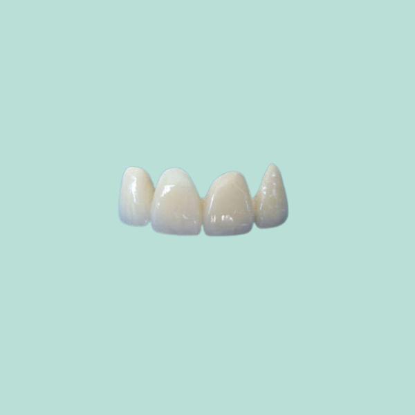 Good Stability Ceramic Dental Crown Fit Properly Oral Hygiene High Quality