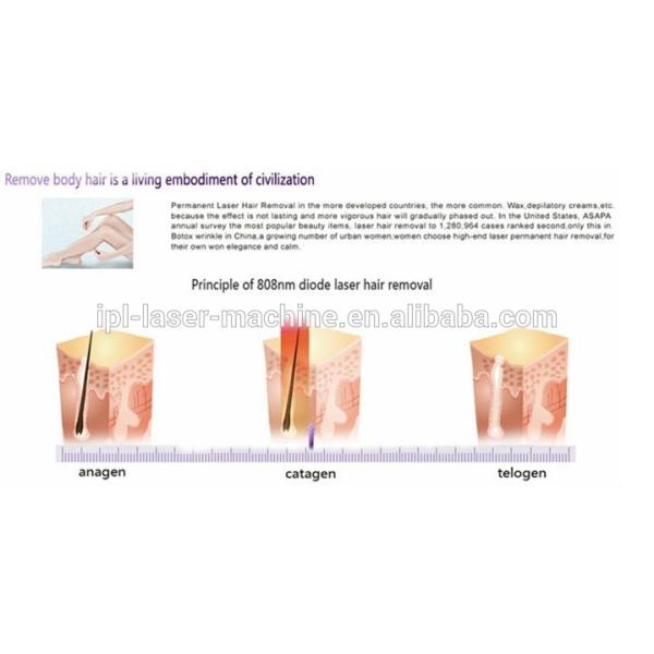 808nm diode laser hair removal machine on sale