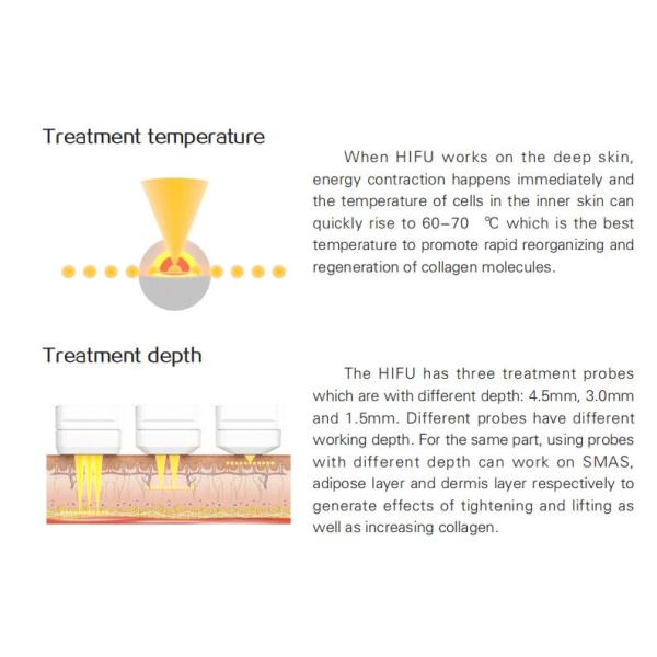 Home Use Portable American HIFU Facelift Machine skin lifting