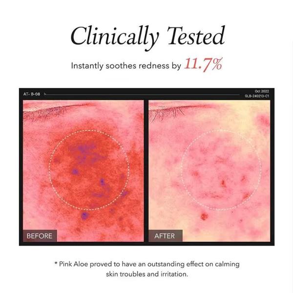 Limpiador exfoliante facial de aloe rosa suave de marca privada, exfoliante, elimina el maquillaje a prueba de agua, protector solar y crema desmaquillante