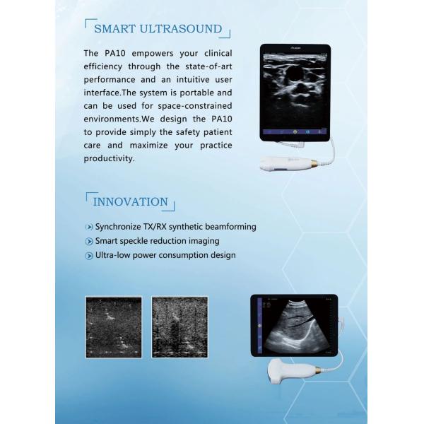 Hot Sale Smart USB Convex Medical Doppler Ultrasound Scanner Ultrasound Probe