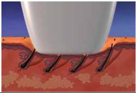 Beauty Salon Beard / Armpit Diode Laser Hair Removal Machine 810nm For Women