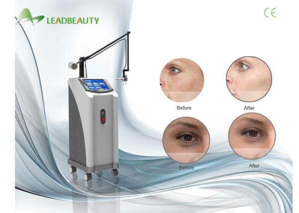 10600nm CO2 Fractional Laser Machine For Removel Surgery Scars / Age / Sun Spots