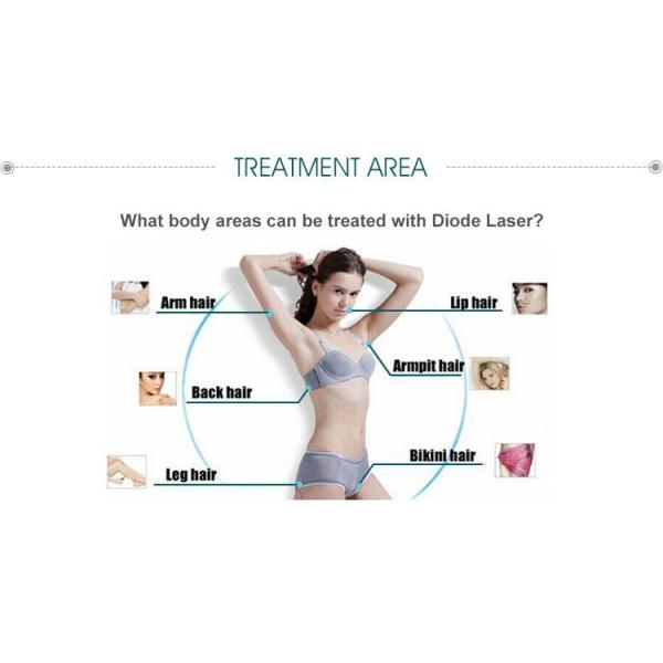 Tripple wavelength Hot sale new technology 808 755 1064 diode laser hair removal/CE and ISO approved!