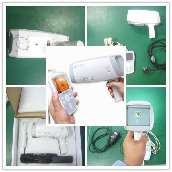 Colposcope камеры цифров Handheld цервикальный для Gynecology для того чтобы проверить Cervix с 80,0000 сигналом разрешения 1~128 пикселов