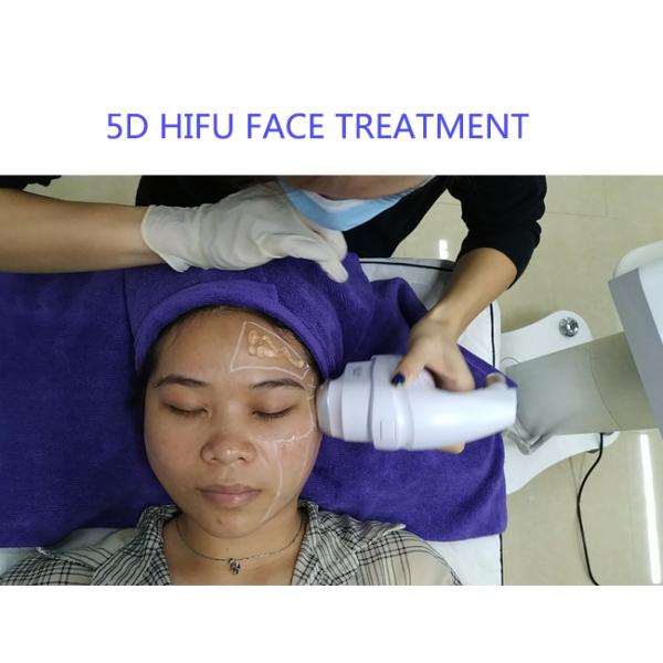 Anti Cellulite Body Slimming 5D Ice Painless Hifu Machine