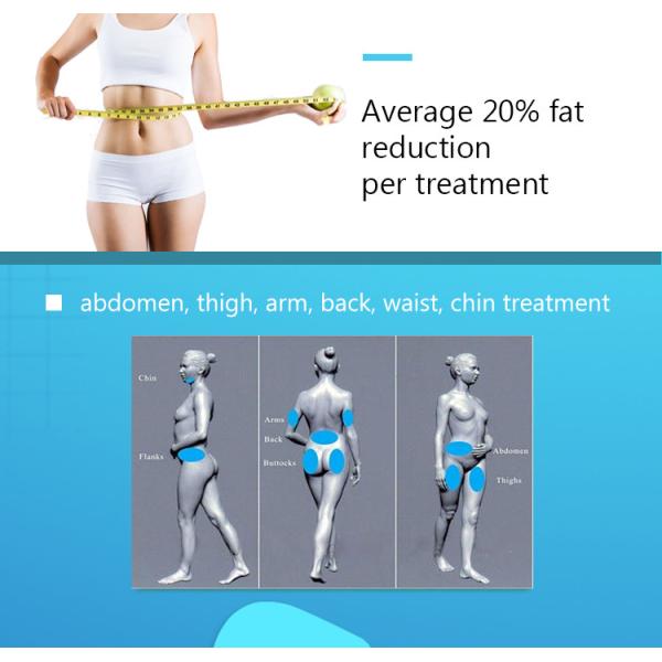 Уменьшение Cryolipolysis целлюлита уменьшая машину с CE