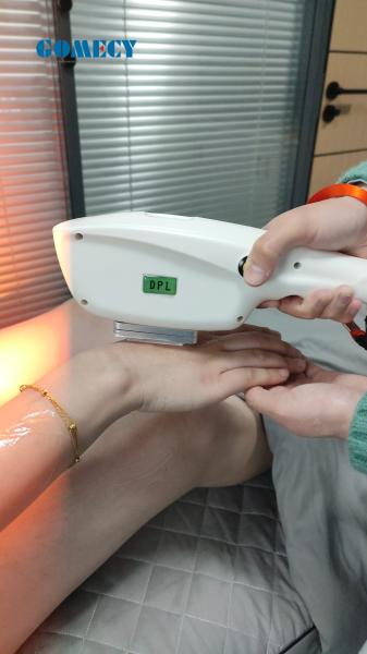 Pro 1500W IPL SH Spa Clinic Depilação a Laser RF Rejuvenato da Pele TEC + Safira (-25 °C)