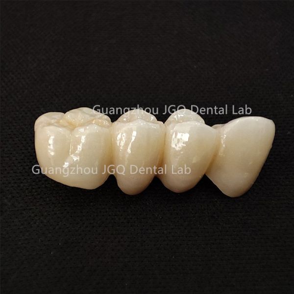 Dental Lab China High Esthetics Full Contour Crown Dental Zirconia Bridge