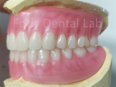 OEM Full Upper And Lower Acrylic Denture Stain Resistance  Natural Color