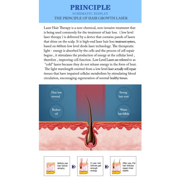 660nm Diode Laser Hair Growth Device For Hair Regeneration / Scalp Nourishment