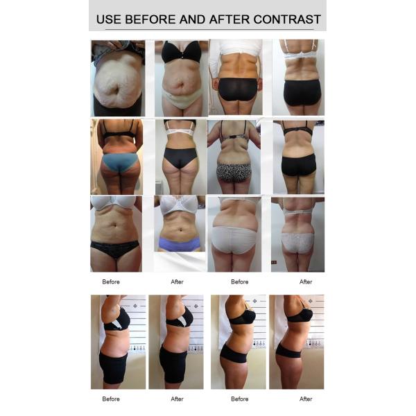 Терапия лазера Липо лазера 4 диодов длины волны подвергает механической обработке 12 пусковых площадок уменьшая машину красоты