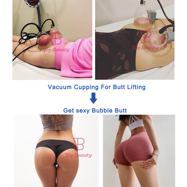 massager усиливающего агента груди вакуума чашки увеличения батокс машина батта электронного придавая форму чашки поднимаясь