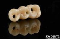 Excellent Biocompatibility And High Strength Color Realistic Full Zirconia For B2B Procurement Solutions