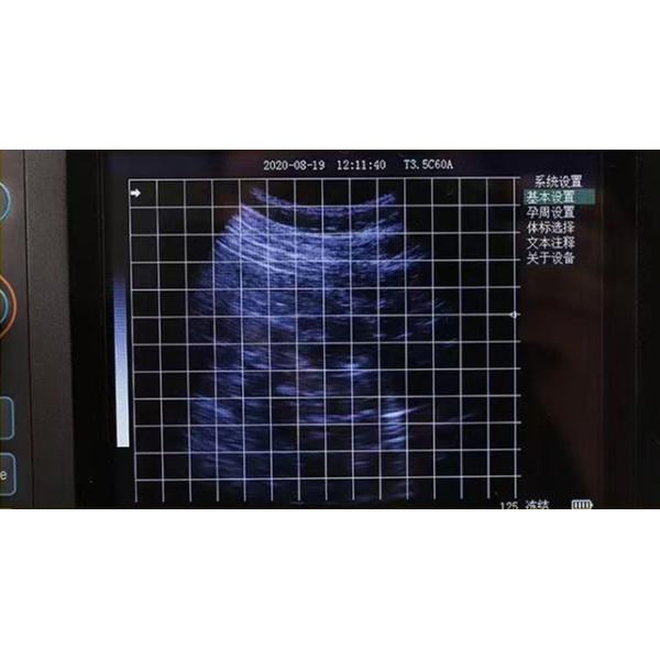 B 5.7 Inch Veterinary Ultrasound Portable Animal Enclosure Handheld Digital Veterinary Ultrasound Machines Veterinary Ultrasound Scanner