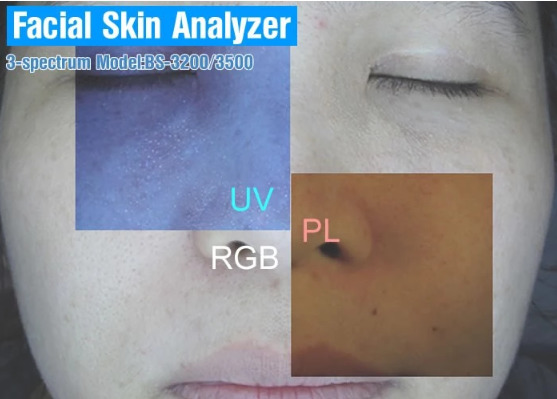 Skin Analyzer Observe Skin Scanner Machine