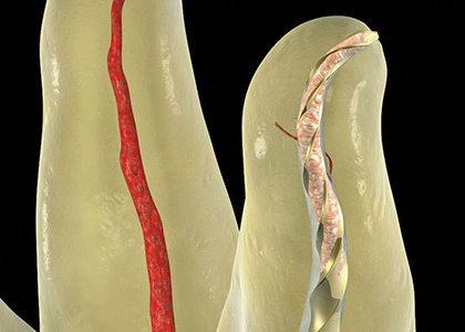 O Pro-atarraxamento dourado dental da ativação do calor arquiva a flexibilidade alta para canais curvados