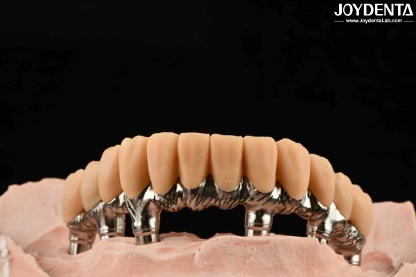 Yellow Resin Temporary Teeth Smooth Surface Treatment Precise And Stable