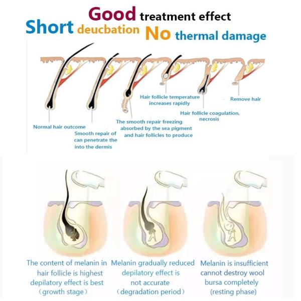 Effective SHR IPL Beauty Equipment For Hair Removal / Skin Rejuvenation