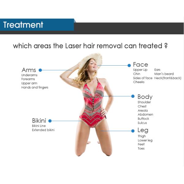 150J 808nm Painless Laser Hair Removal Machine 12mmX12mm Spot