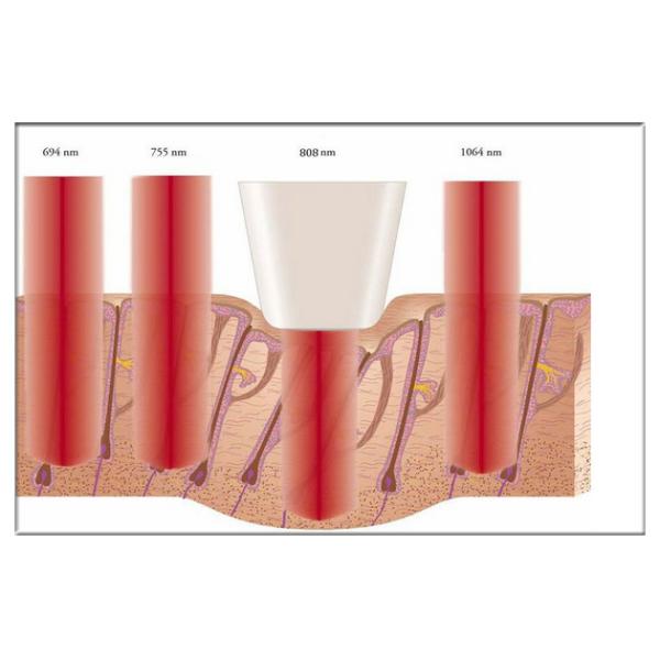 Multifunction Adjustable 25 - 400 ms Diode Laser 808nm Hair Removal Machine