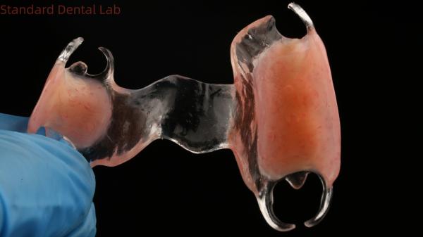 Estrutura de metal fundido transparente flexível Dentes parciais Alta estética Perfeito ajuste