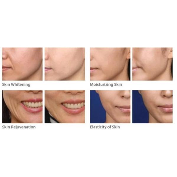 Анти- старея игла вводимое Mesotherapy младенца ракеты -носителя PDRN кожи