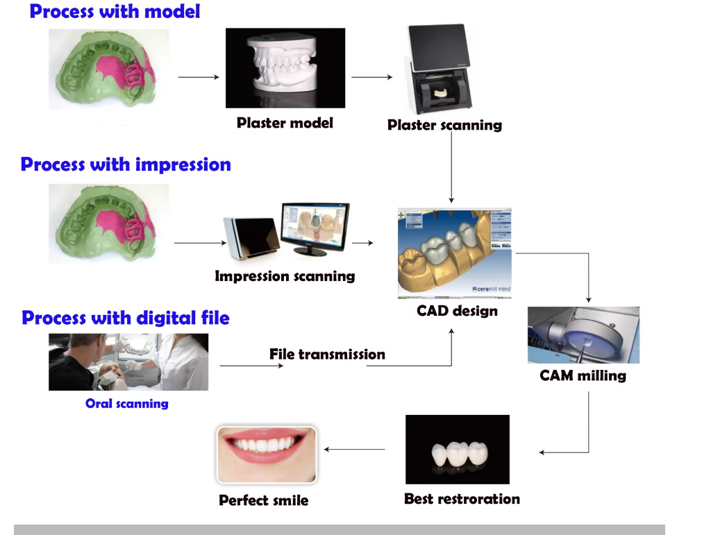 Diagnostic Wax-Up for Porcelain Veneers