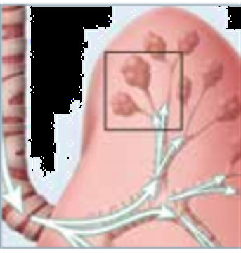 Portable Healthcare Vest Airway Clearance System Devices 220V