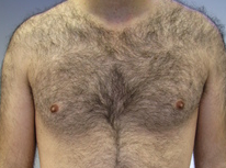 IPL hair removal,skin rejuvenation device,pigment removal equipment